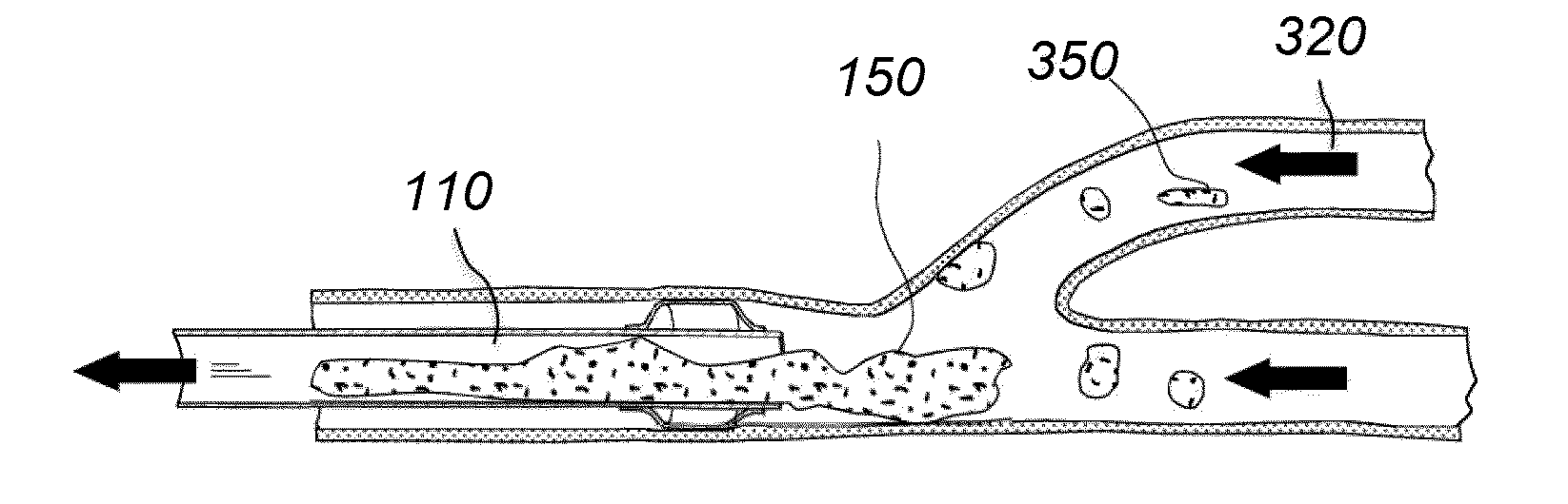 Post-conditioning suction catheter apparatus and methods