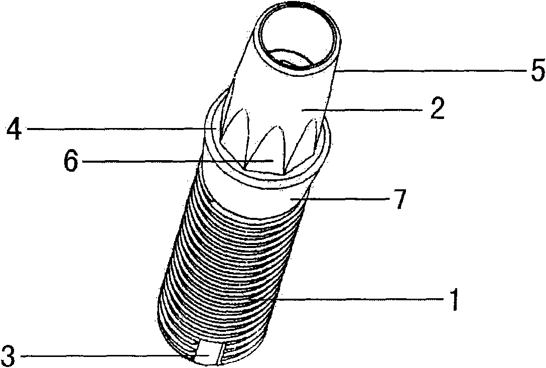 Zirconium oxide tooth implantation system