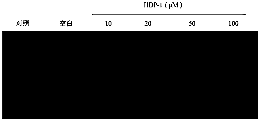 Application of polypeptide HDP-1 of Haliotis discus hannai to preparation of drugs used for preventing and treating tumors and diseases related to oxidation