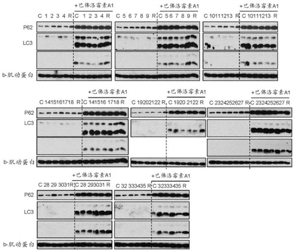 Autophagy improvement material and its application