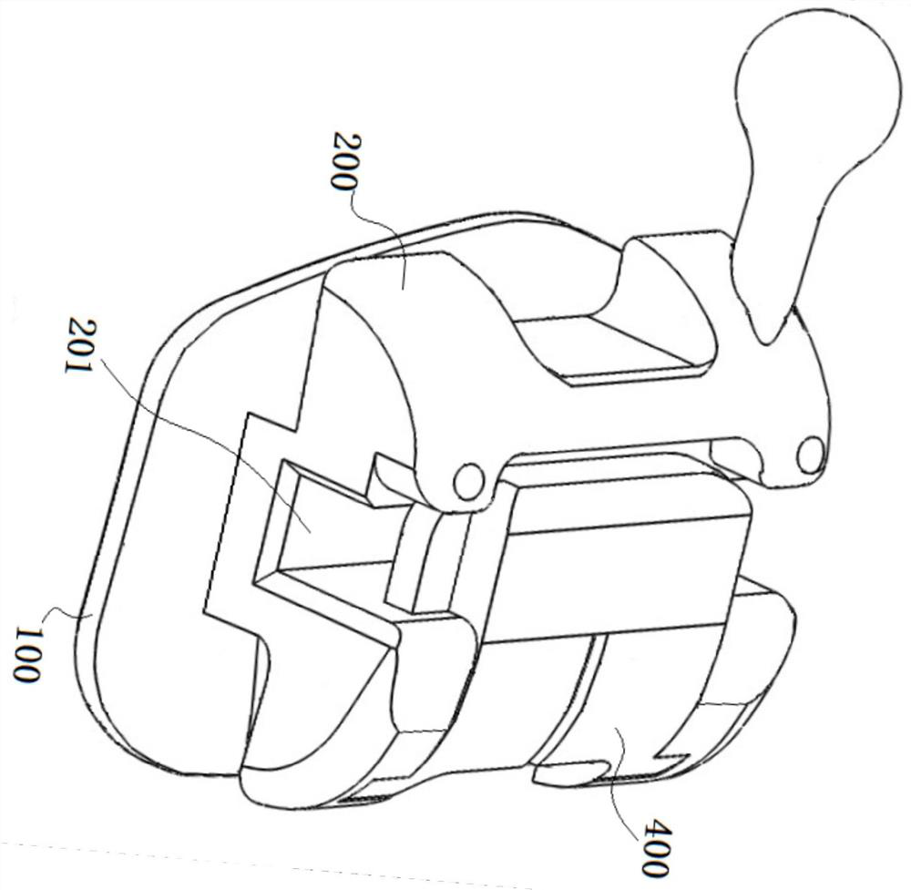 Self-locking orthodontic bracket and preparation method thereof