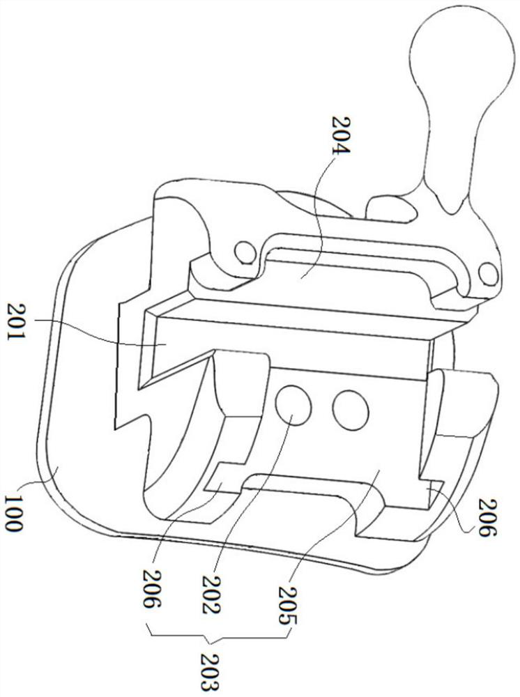 Self-locking orthodontic bracket and preparation method thereof