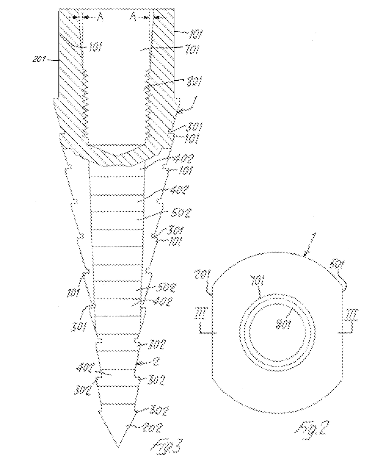 Endosseous Dental Implant