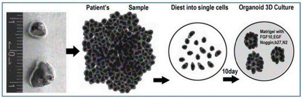 Culture medium for 3D culture of lung tissue