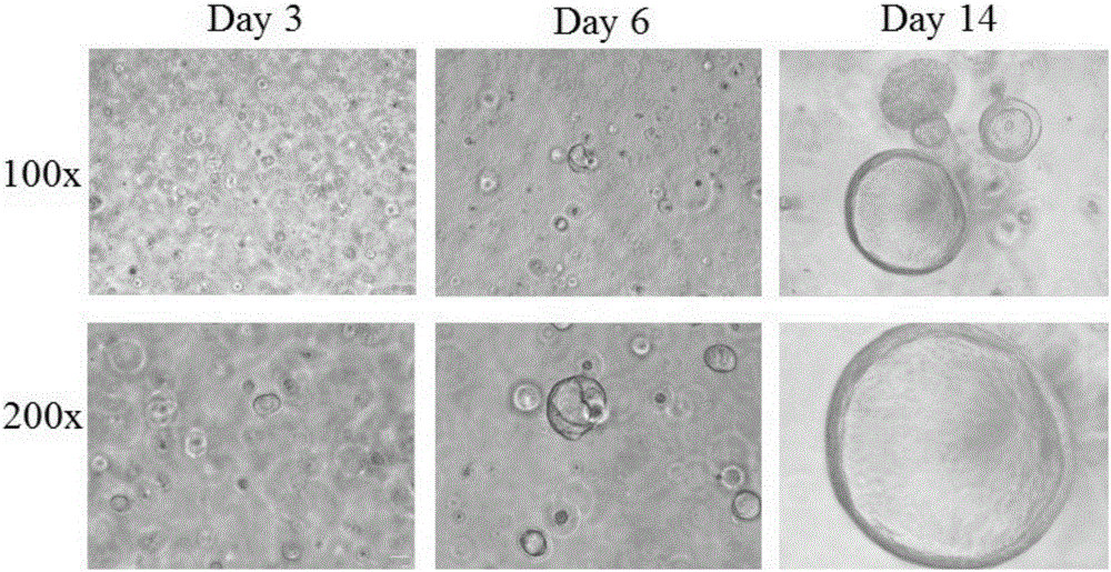 Culture medium for 3D culture of lung tissue