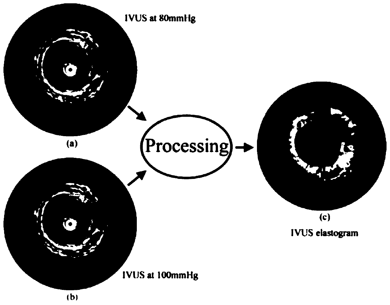 Vascular guided wave elastography method and system based on machine learning