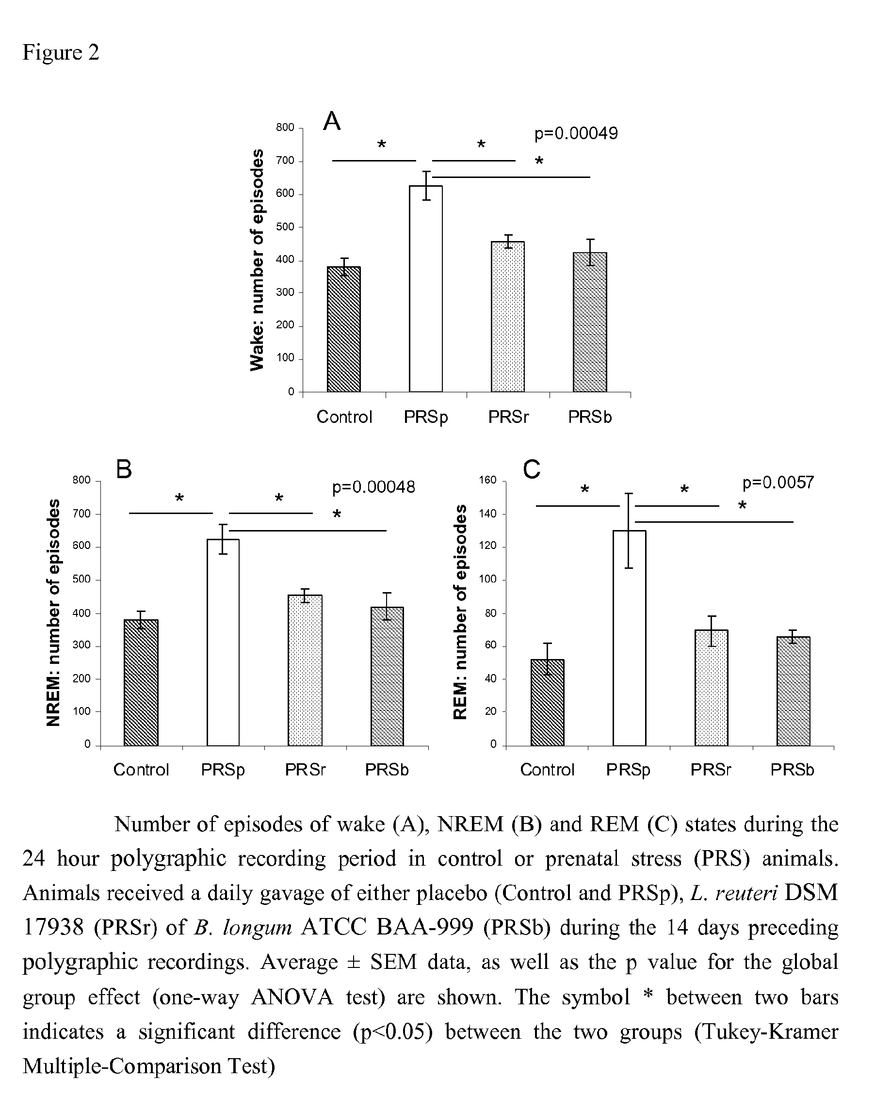 Nutritional composition comprising probiotics and improving sleep patterns