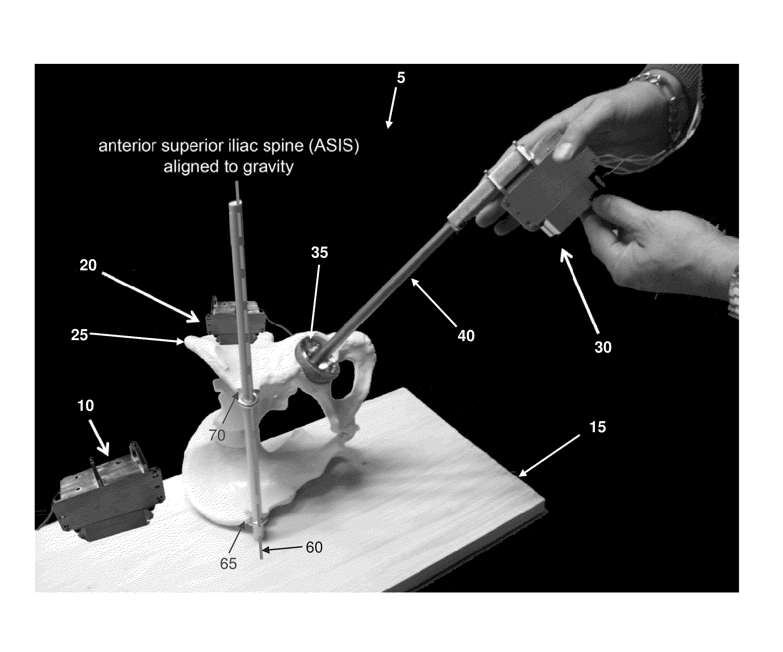 Computer-guided system for orienting a prosthetic acetabular cup in the acetabulum during total hip replacement surgery