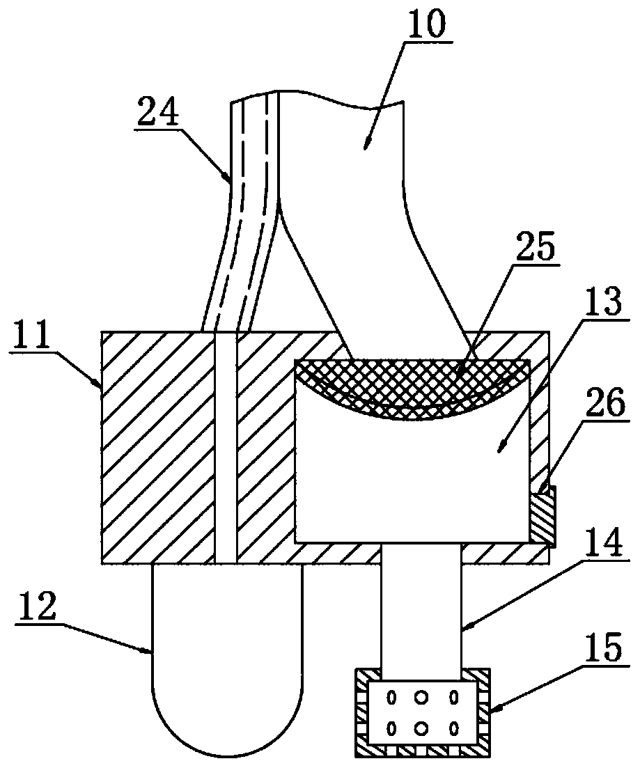 Multifunctional digestive endoscope treatment device