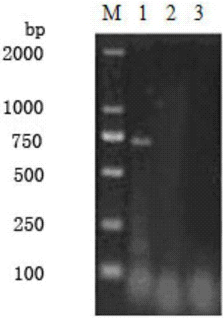 Bivalent egg yolk antibody against DVH (duck virus hepatitis) as well as preparation method and application of bivalent egg yolk antibody