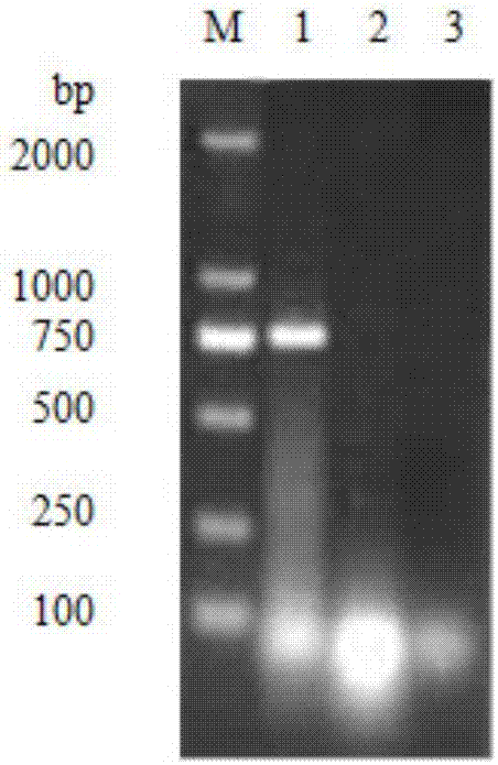 Bivalent egg yolk antibody against DVH (duck virus hepatitis) as well as preparation method and application of bivalent egg yolk antibody