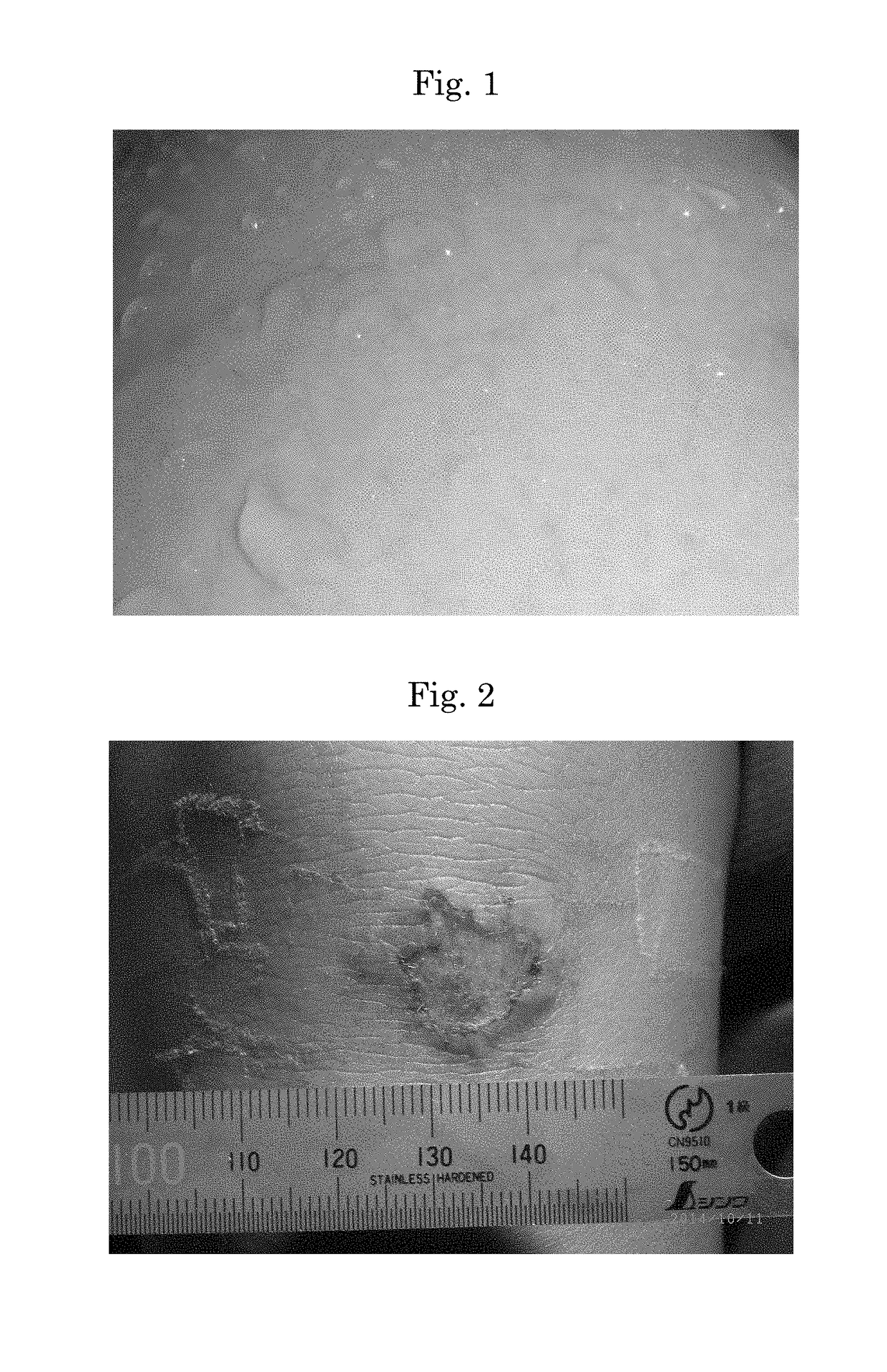 Method for coating skin abrasion, laceration, burn or oedema after surgery