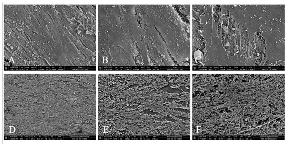 Preparation method of acellular matrix and cyclopentenone prostaglandin composition