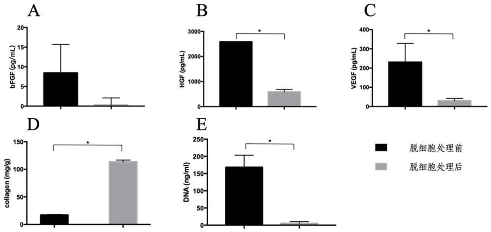 Preparation method of acellular matrix and cyclopentenone prostaglandin composition