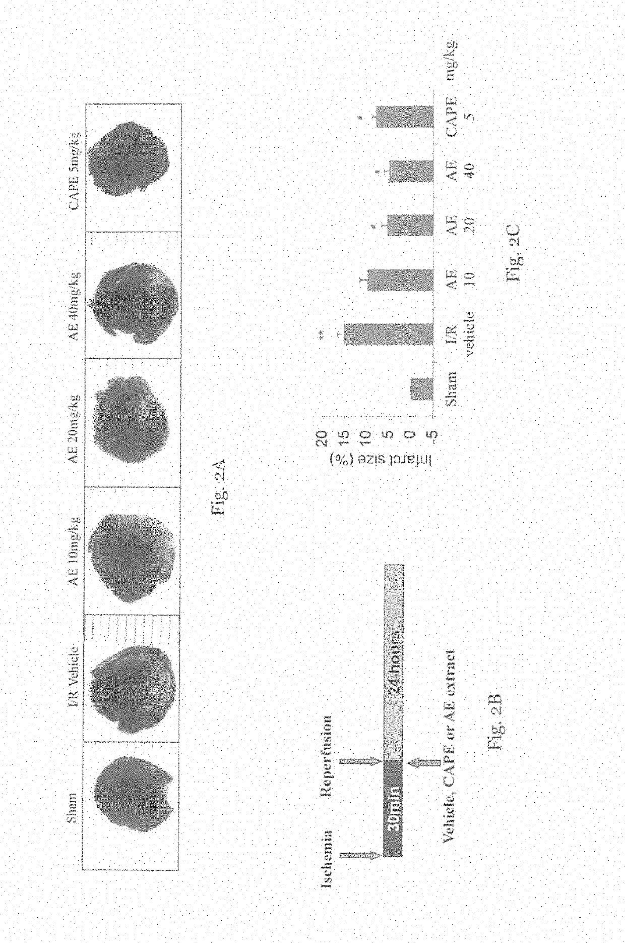 Caffeoylquinic acid-rich extract and preparation as well as use thereof