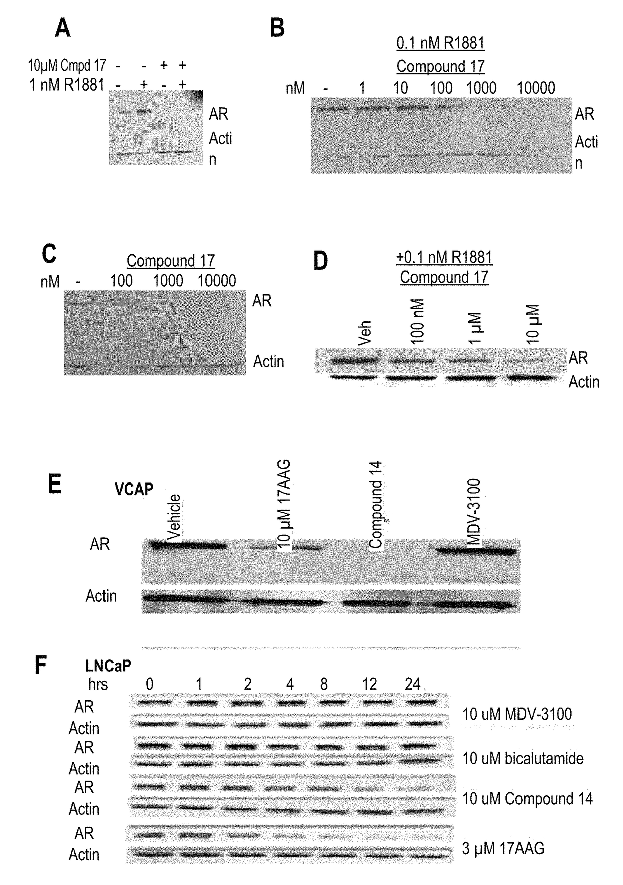 Selective androgen receptor degrader (SARD) ligands and methods of use thereof