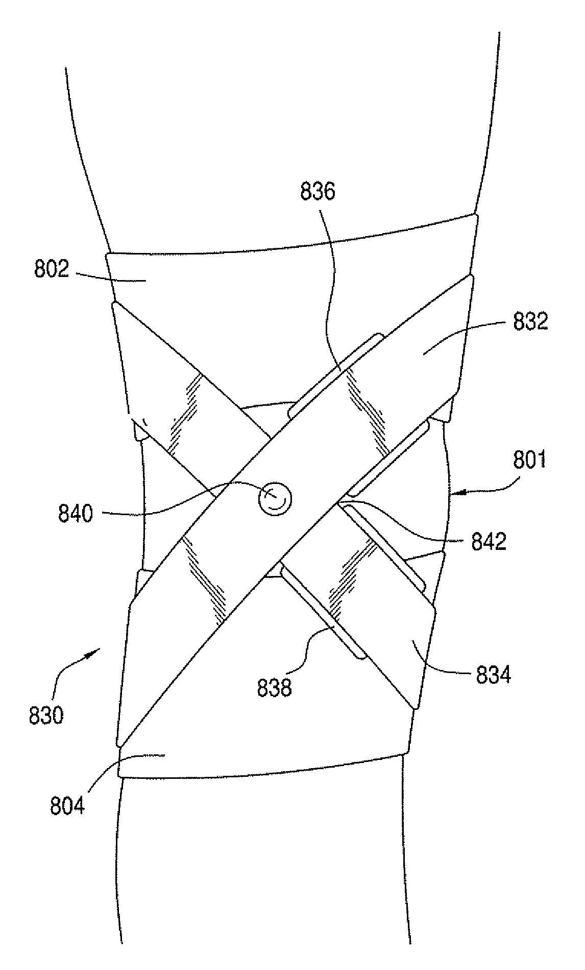 Orthopedic device