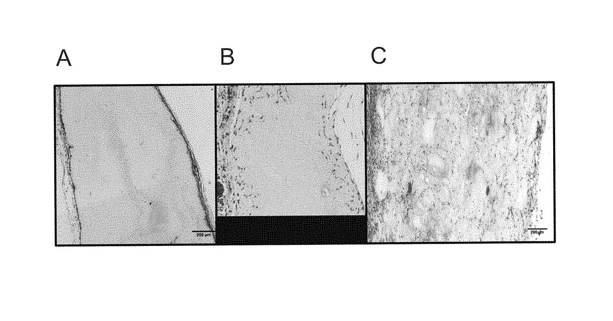 Tissue scaffold materials for tissue regeneration and methods of making