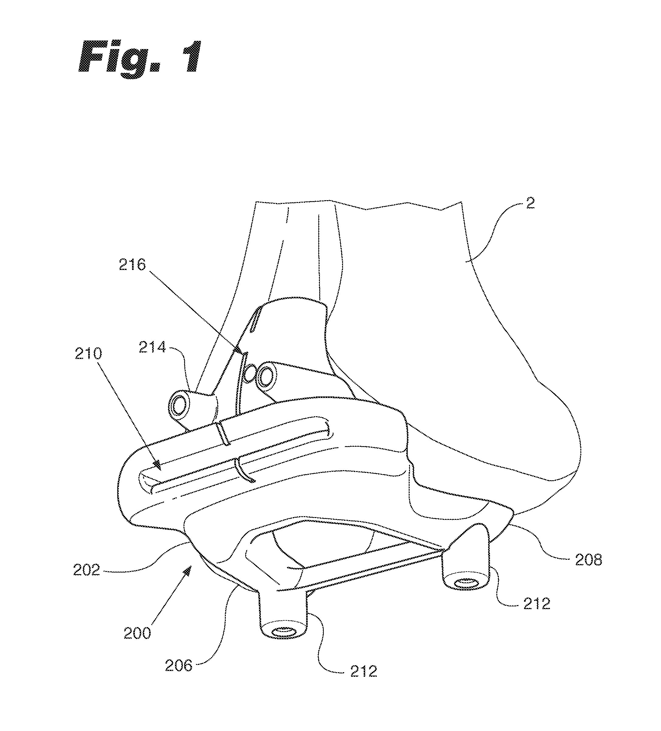 Patient match instrument