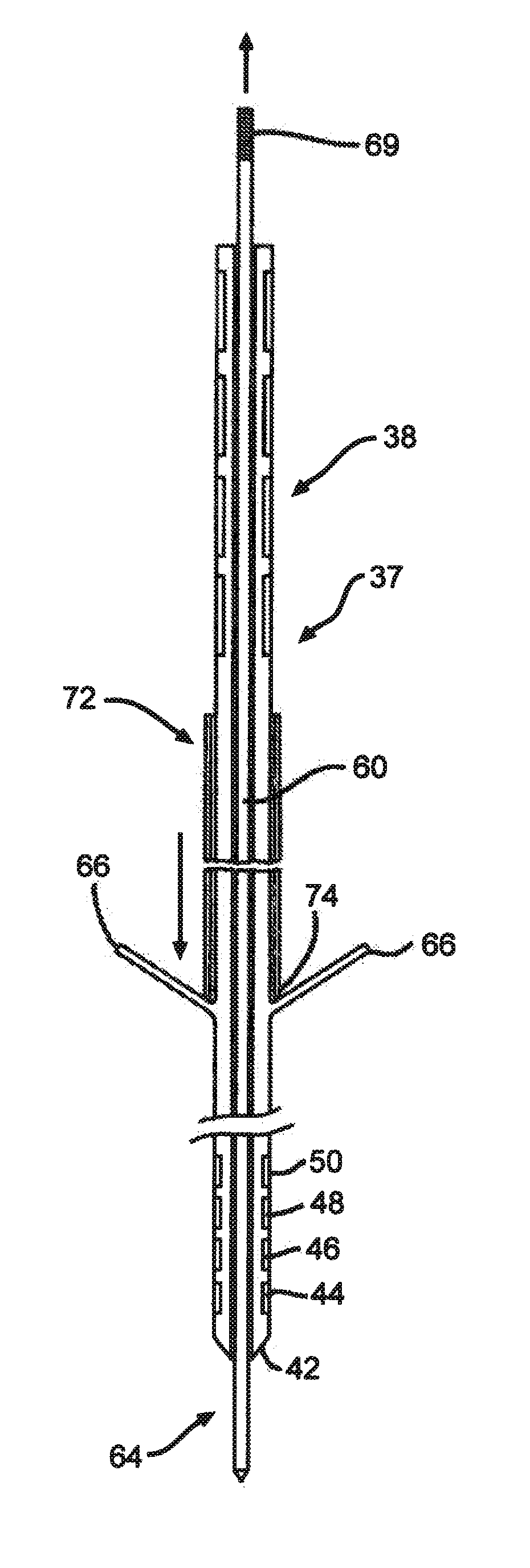 Minimally invasive methods for implanting a sacral stimulation lead