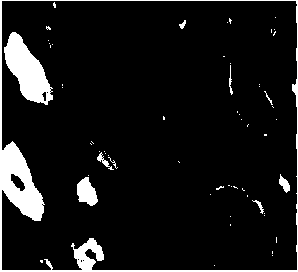 Method for extracting total flavonoid in pteridium aquilinum by ultrasound-assisted compound enzyme method