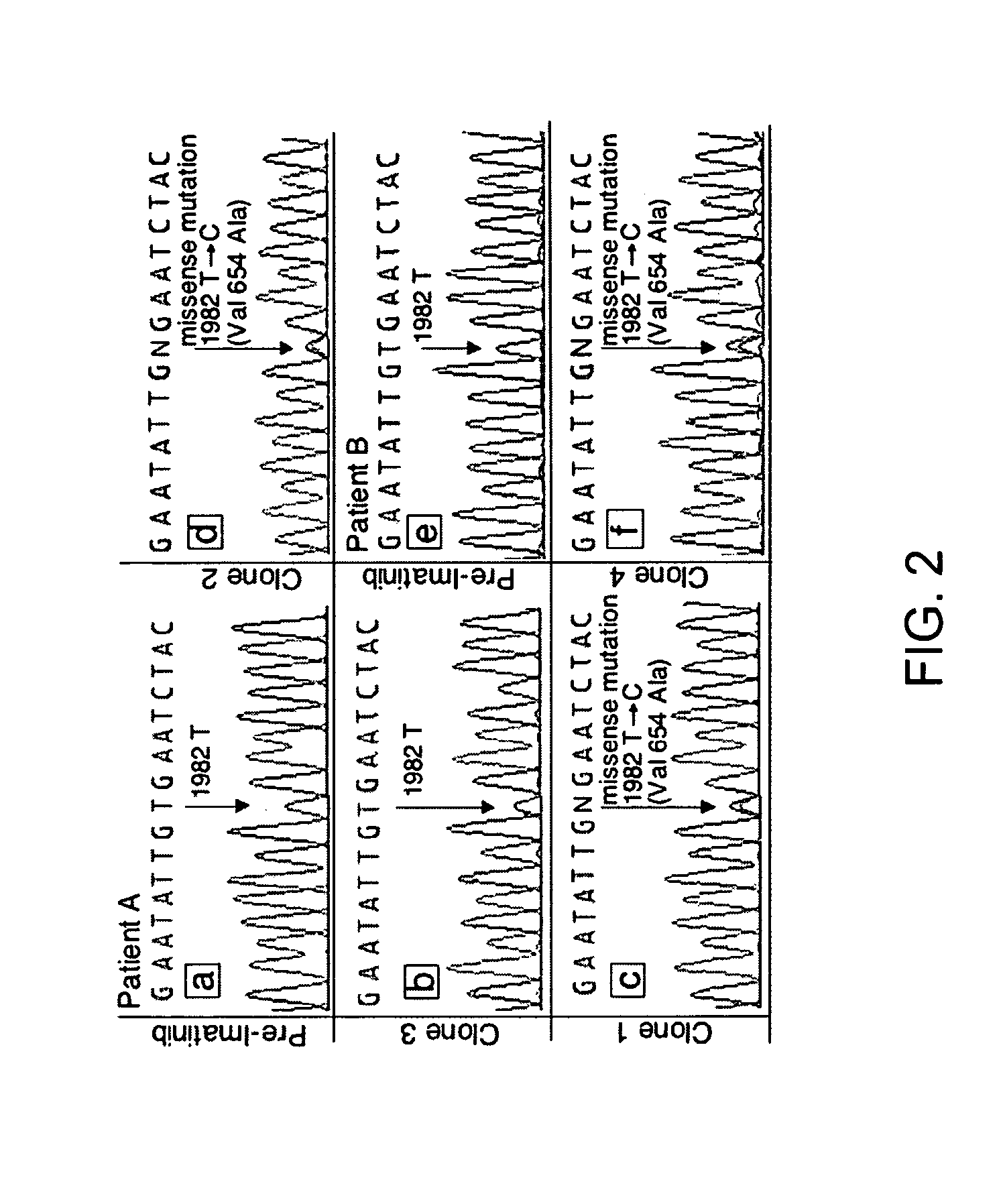 Mutations in KIT confer imatinib resistance in gastrointestinal stromal tumors