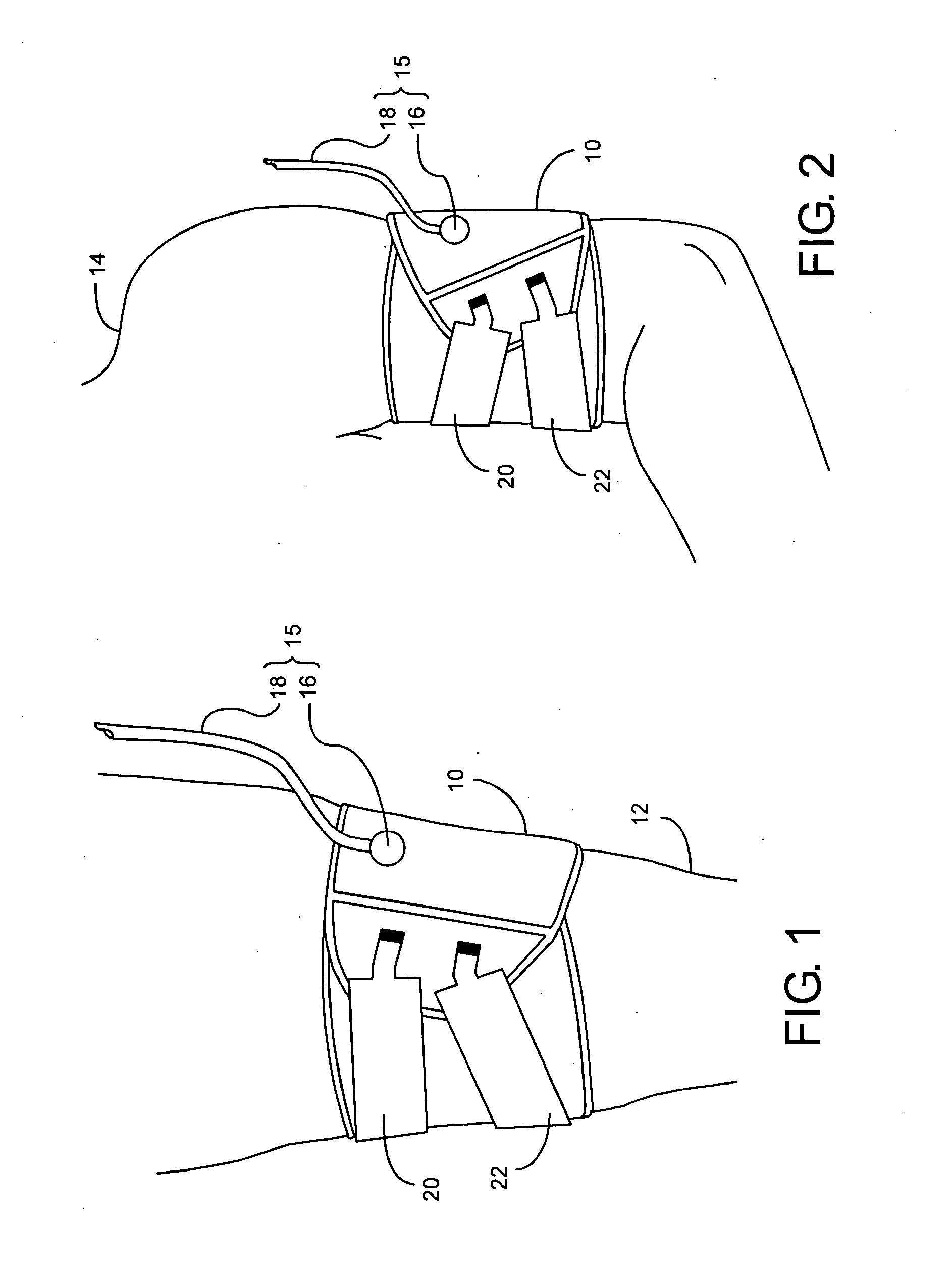 Low-cost contour cuff for surgical tourniquet systems