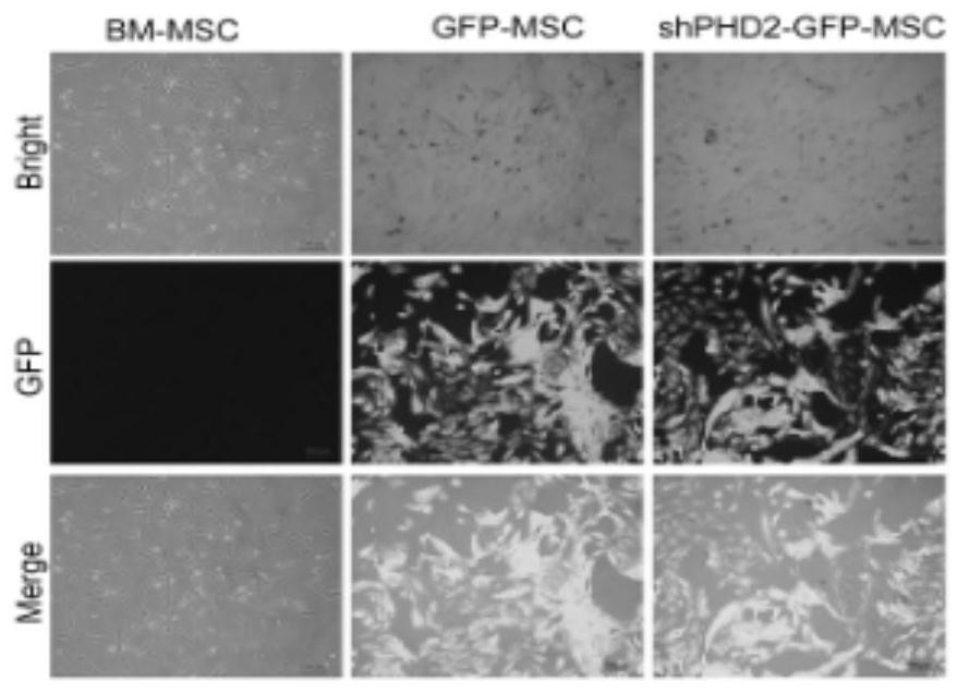 Method for preparing BM-MSCs conditioned medium, conditioned medium and application