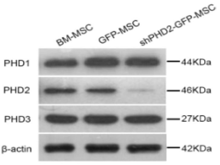 Method for preparing BM-MSCs conditioned medium, conditioned medium and application