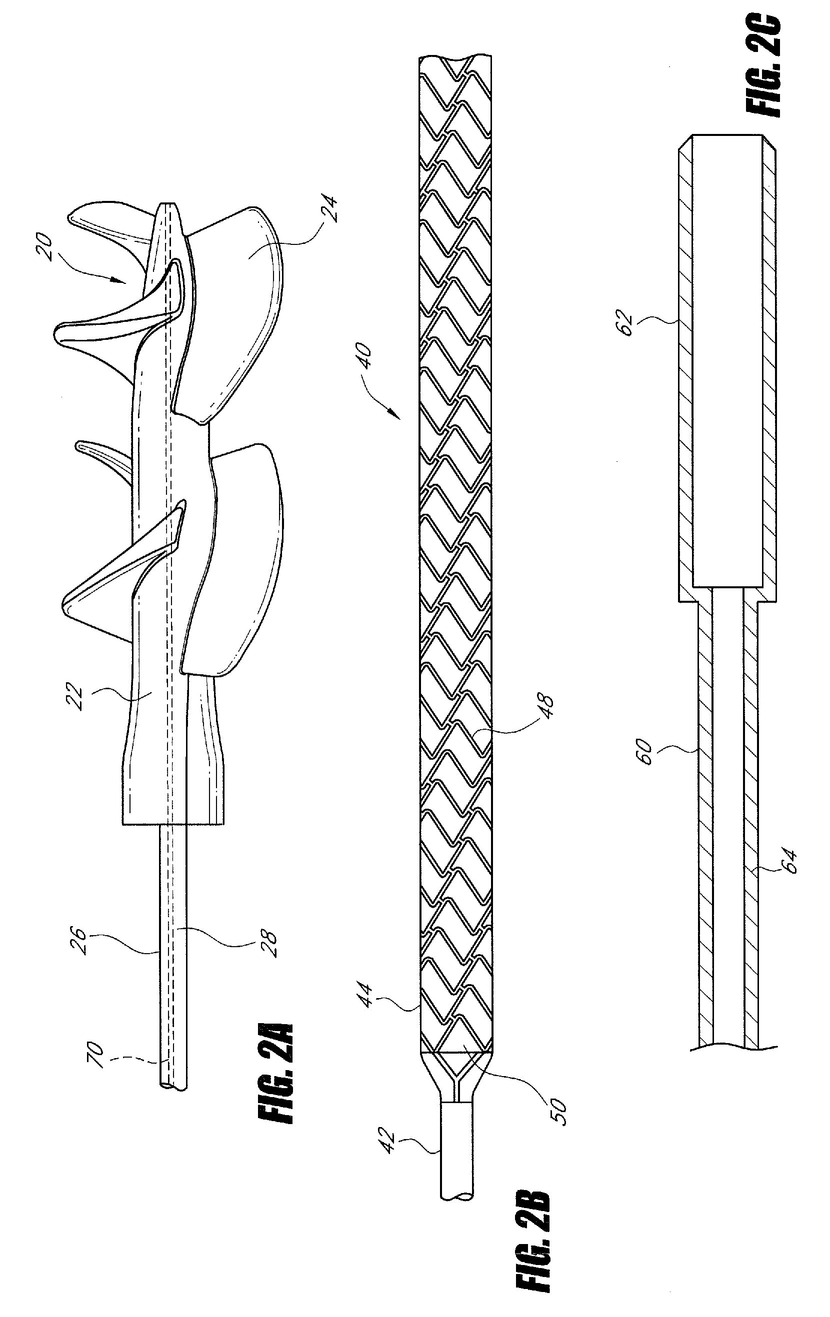 Blood pump with expandable cannula