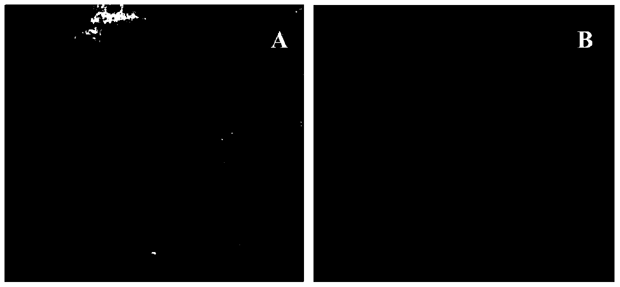 Preparation method and application of capillary reconstruction (therapeutic angiogenesis) targeted magnetic resonance contrast agent