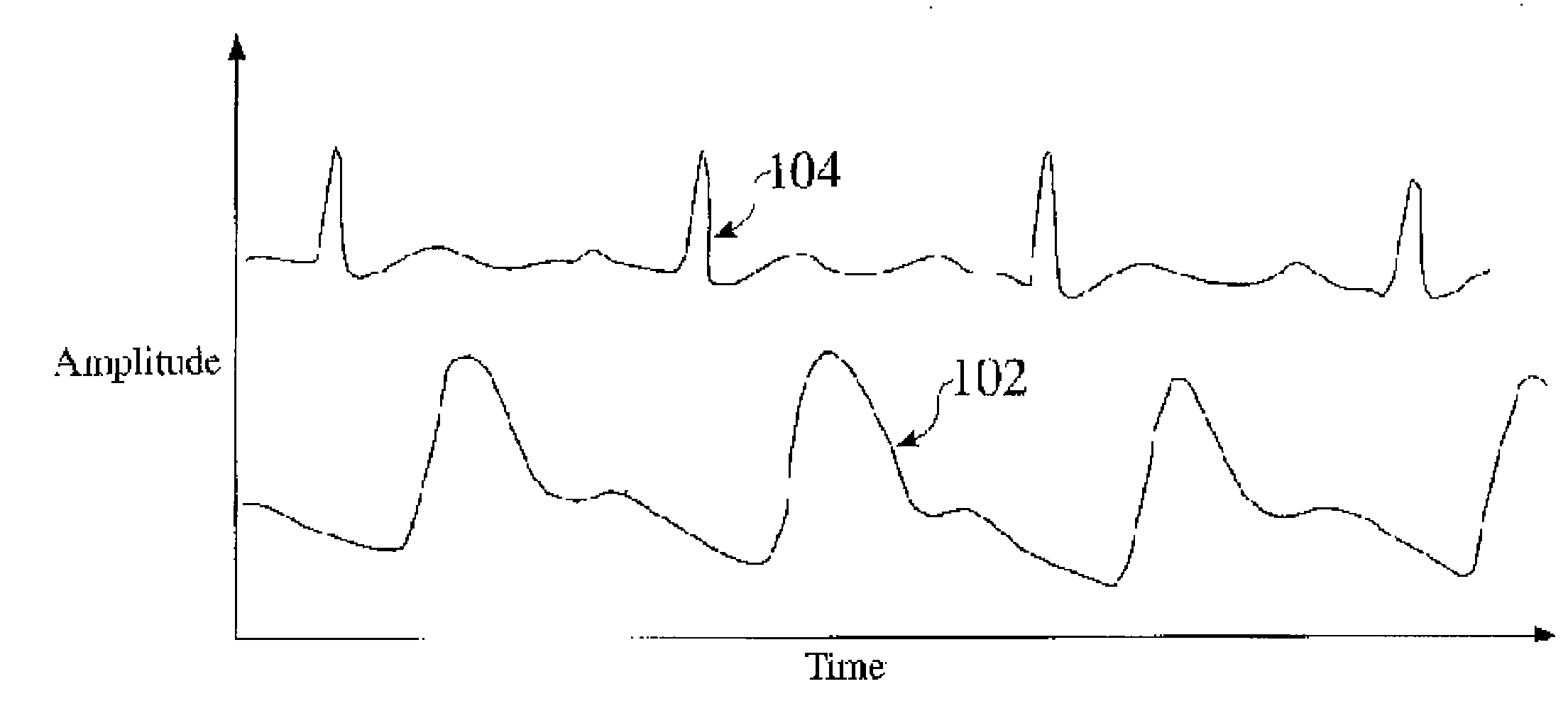 Methods, systems and devices for monitoring respiratory disorders