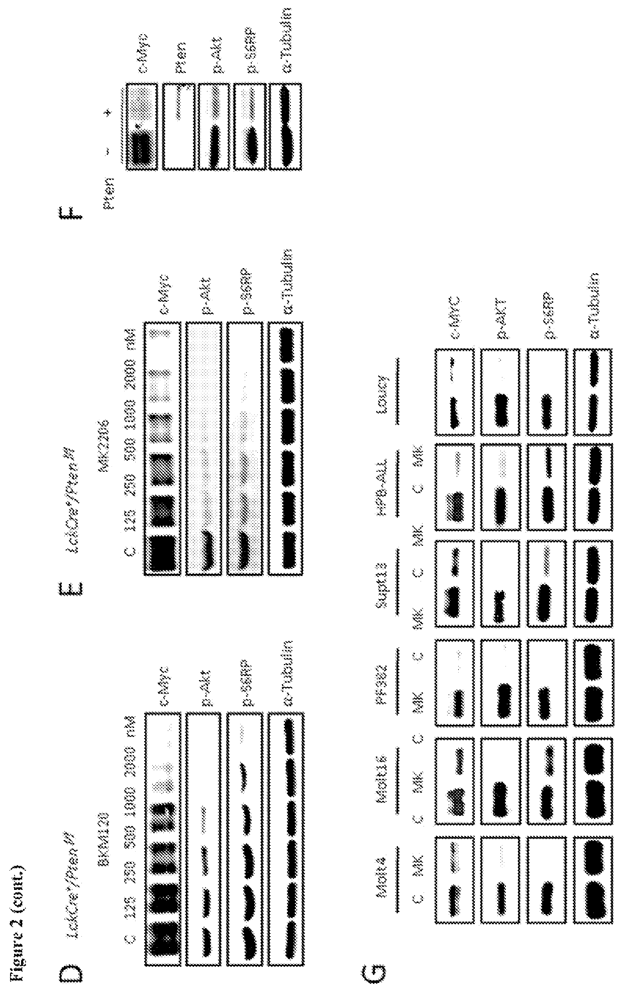 P13K-MTORC1-S6K1 signaling pathway biomarkers predictive of anti-cancer responses