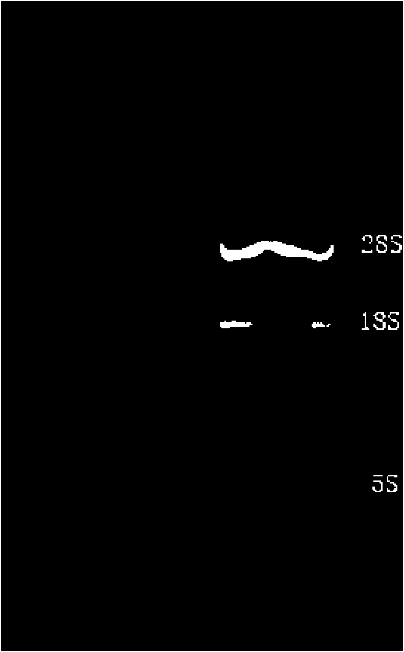 Anti-EGFR single-chain antibody fusion Gelonin recombination immunotoxin, preparation method and usage thereof