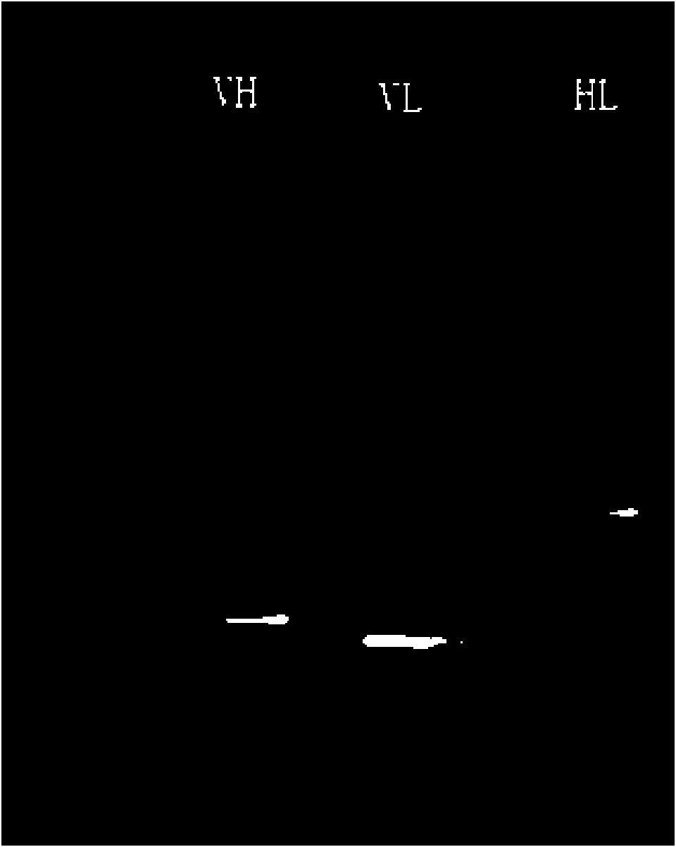 Anti-EGFR single-chain antibody fusion Gelonin recombination immunotoxin, preparation method and usage thereof