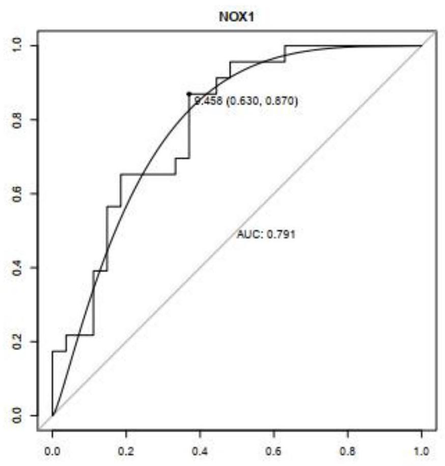 Marker for predicting sensitivity of rectal cancer patient to bevacizumab