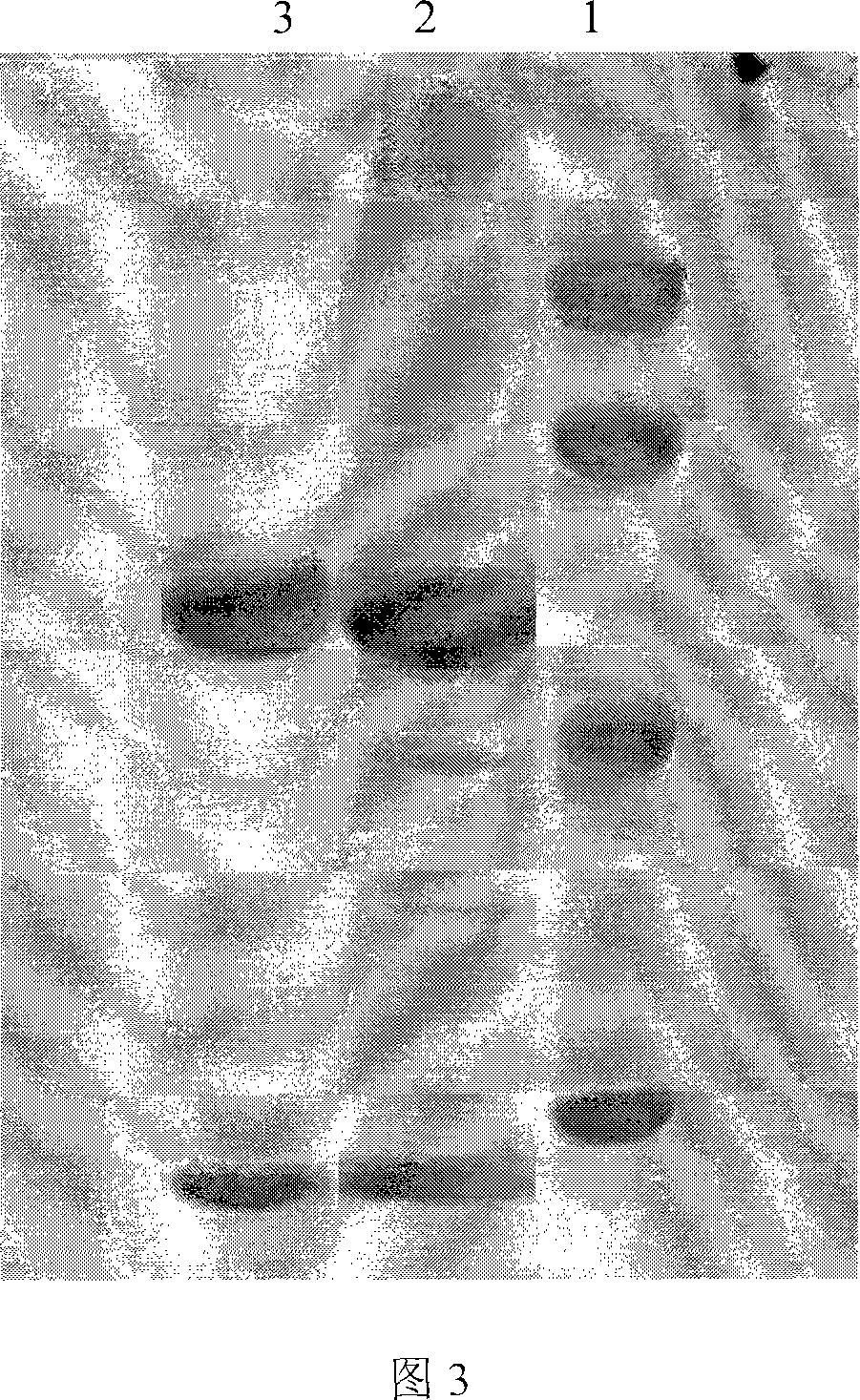 Method for preparing A gene of recombined protein, and expressed products and application