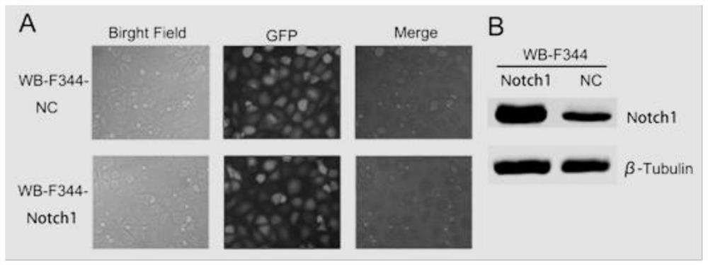 A method for inducing transformation of adult liver stem cells into highly metastatic liver cancer cells and corresponding cells