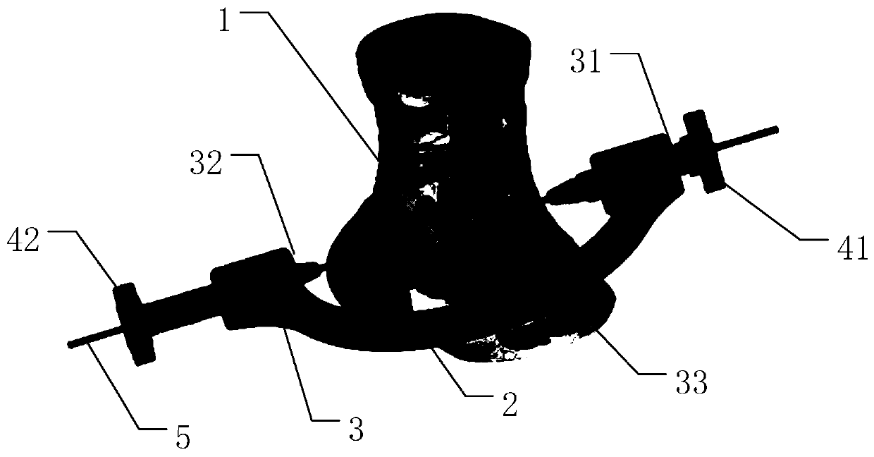 An individualized subtalar arthrodesis guide plate and manufacturing method thereof