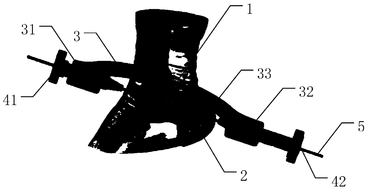 An individualized subtalar arthrodesis guide plate and manufacturing method thereof