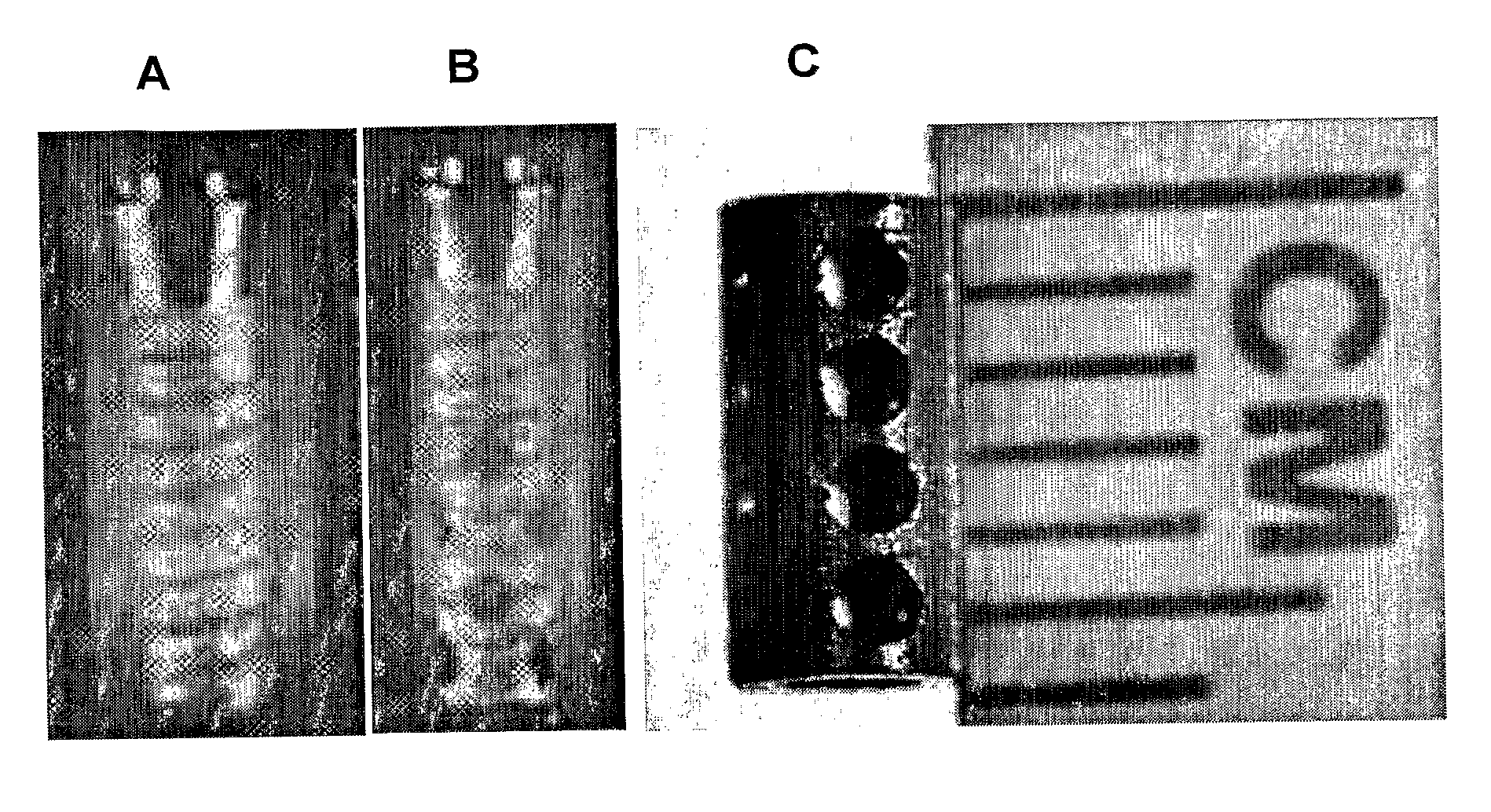 Hollow and Porous Orthopaedic or Dental Implant that Delivers a Biological Agent