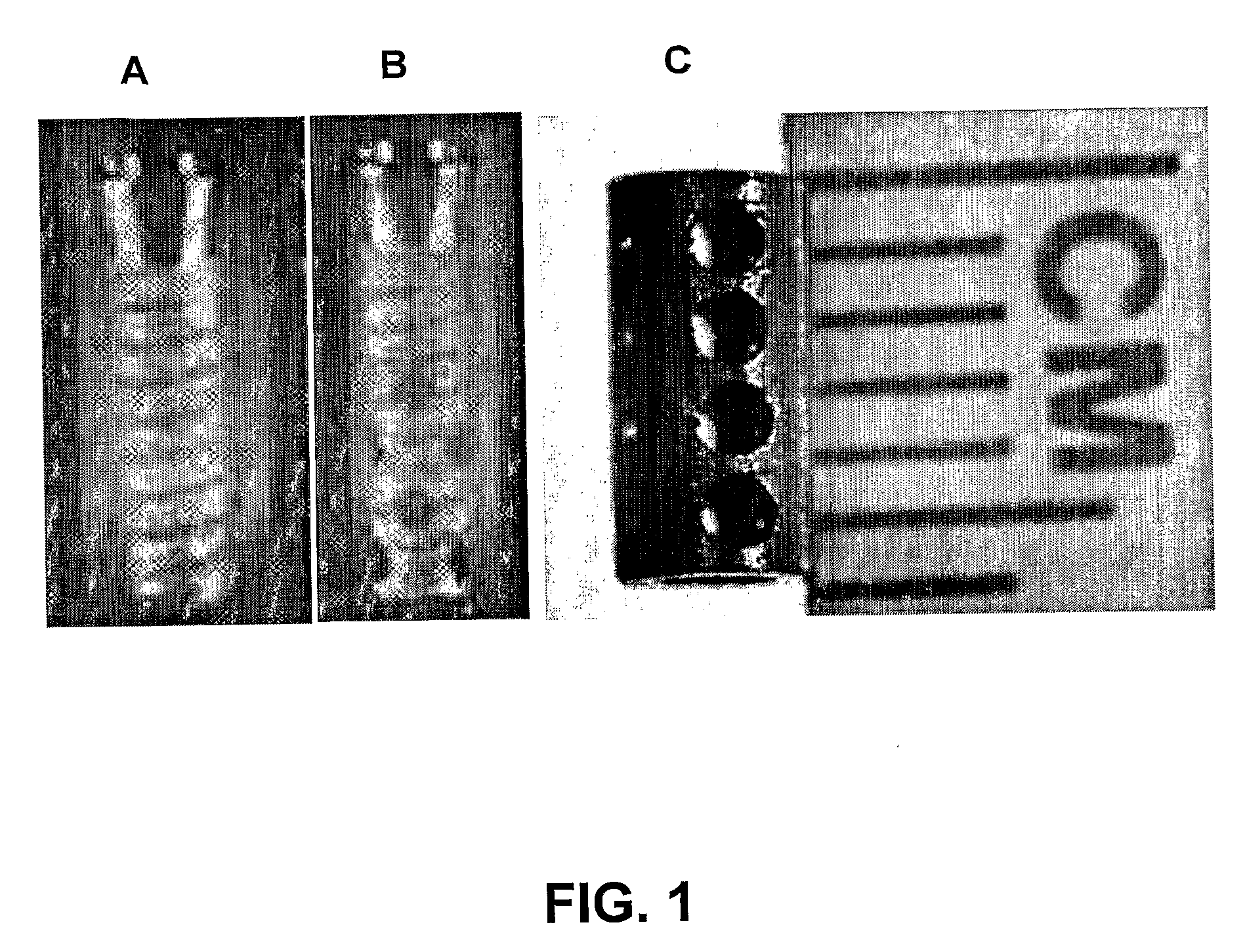 Hollow and Porous Orthopaedic or Dental Implant that Delivers a Biological Agent