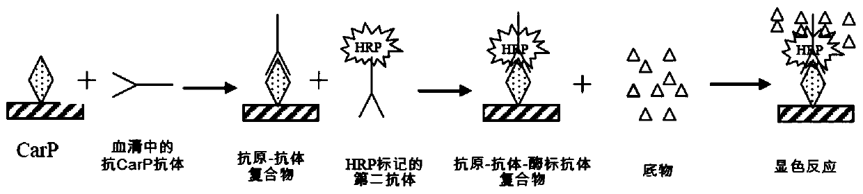 Application of anti-CarP (Carbamylated protein) antibodies as systemic lupus erythematosus (SLE) diagnostic marker