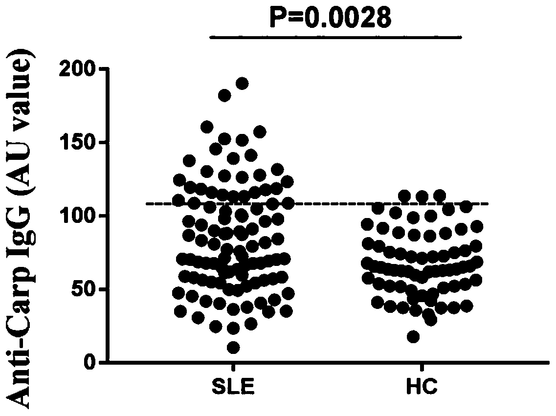 Application of anti-CarP (Carbamylated protein) antibodies as systemic lupus erythematosus (SLE) diagnostic marker