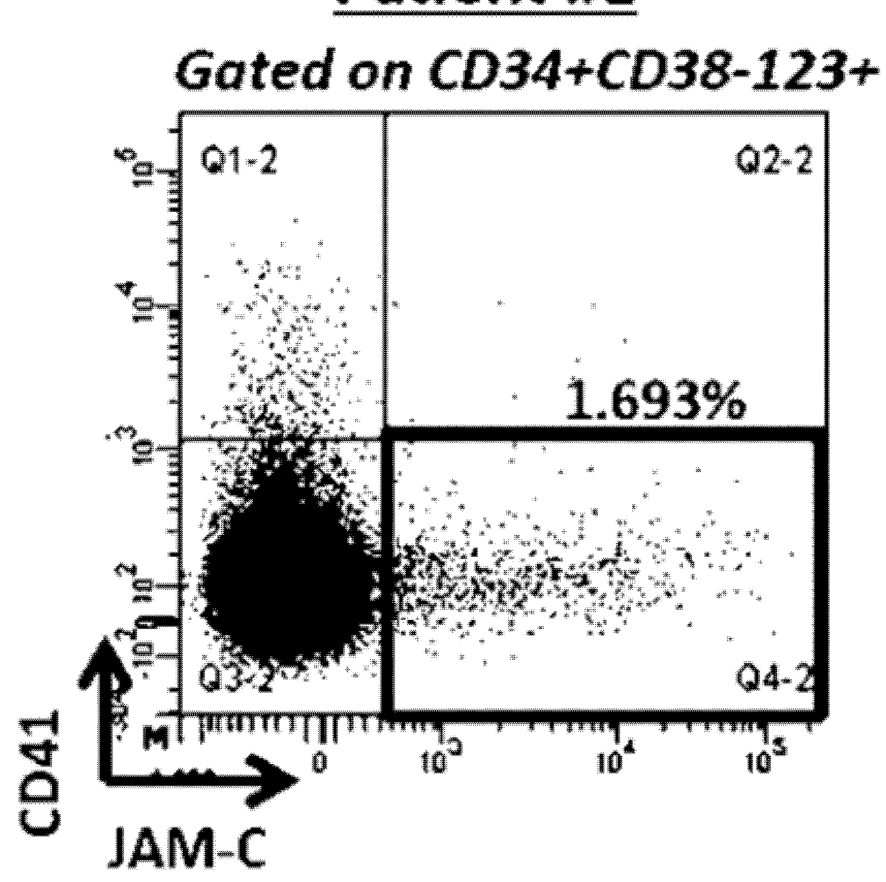 New biomarker for outcome in aml