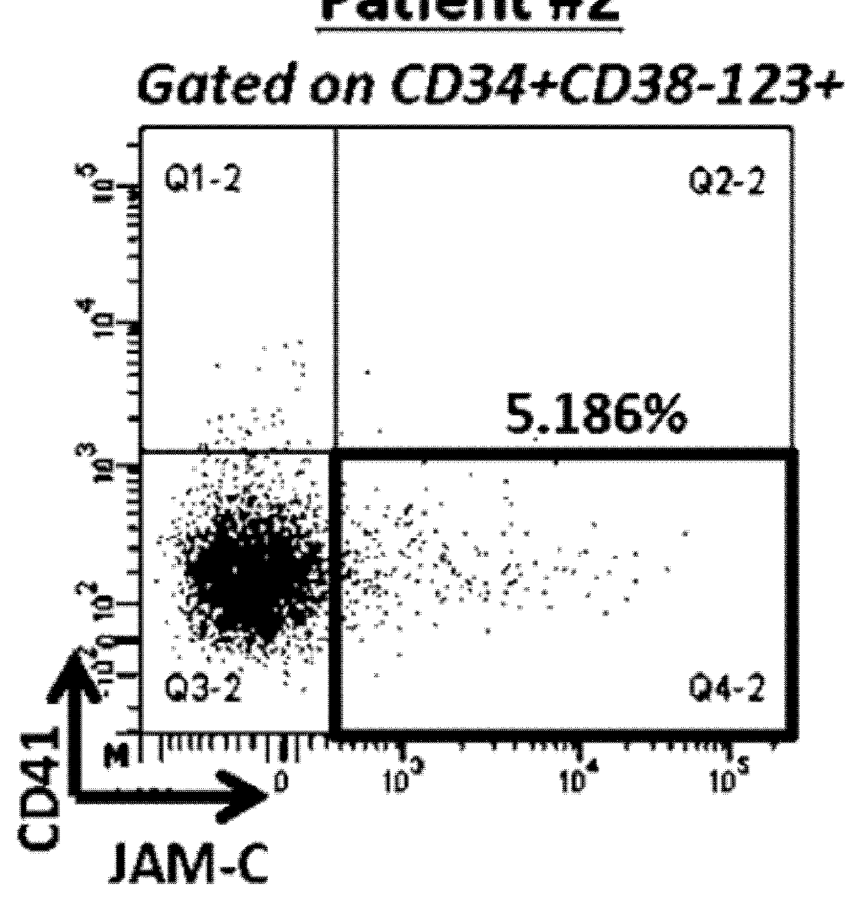 New biomarker for outcome in aml