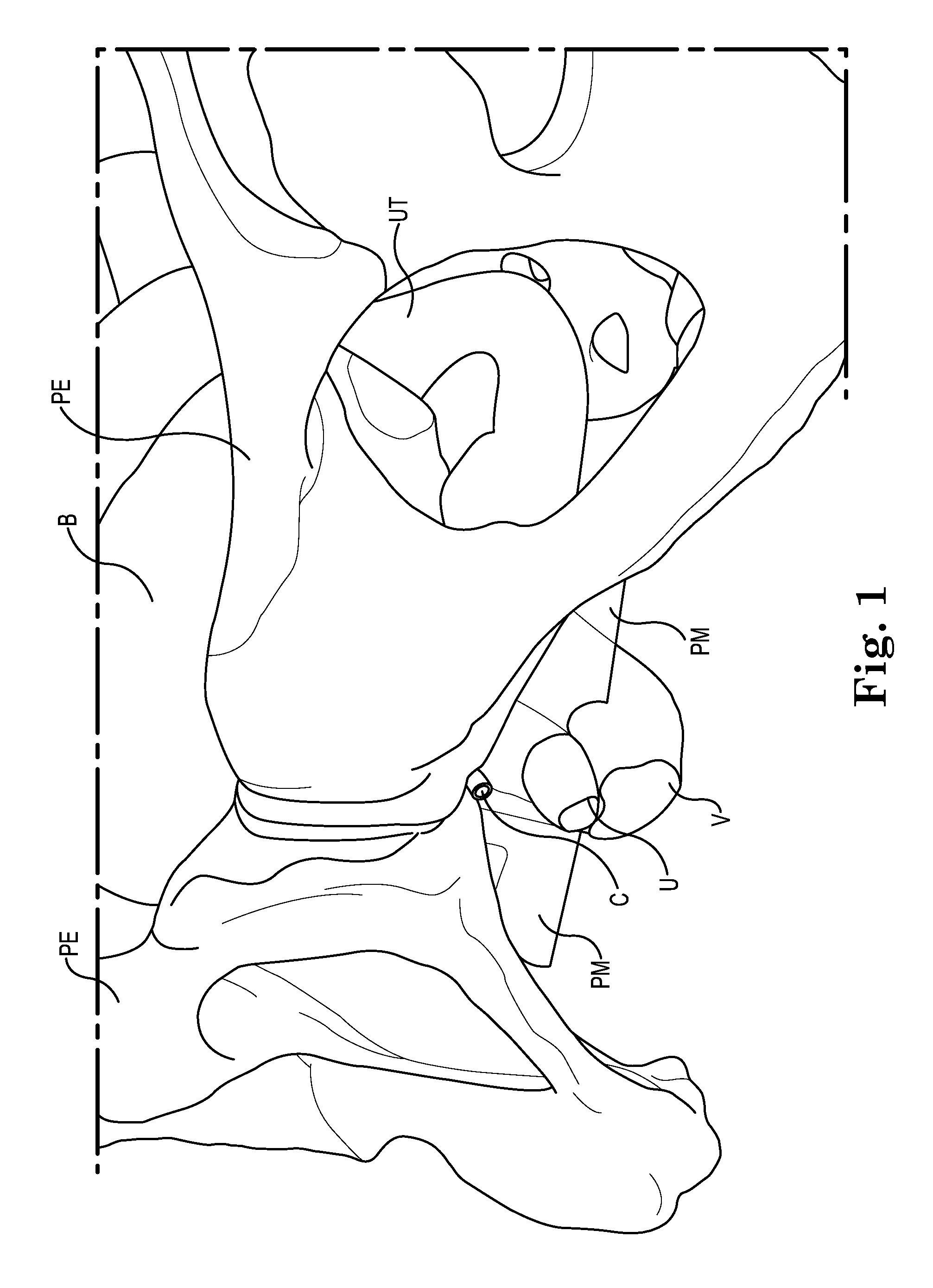 Pelvic implant system and method