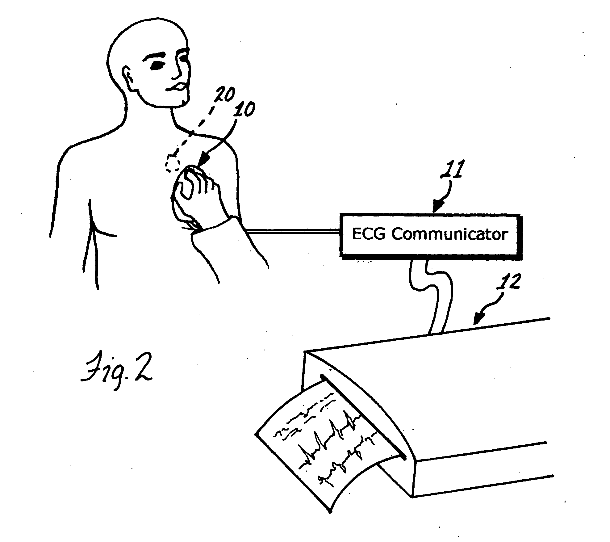 ECG diagnostic system and method