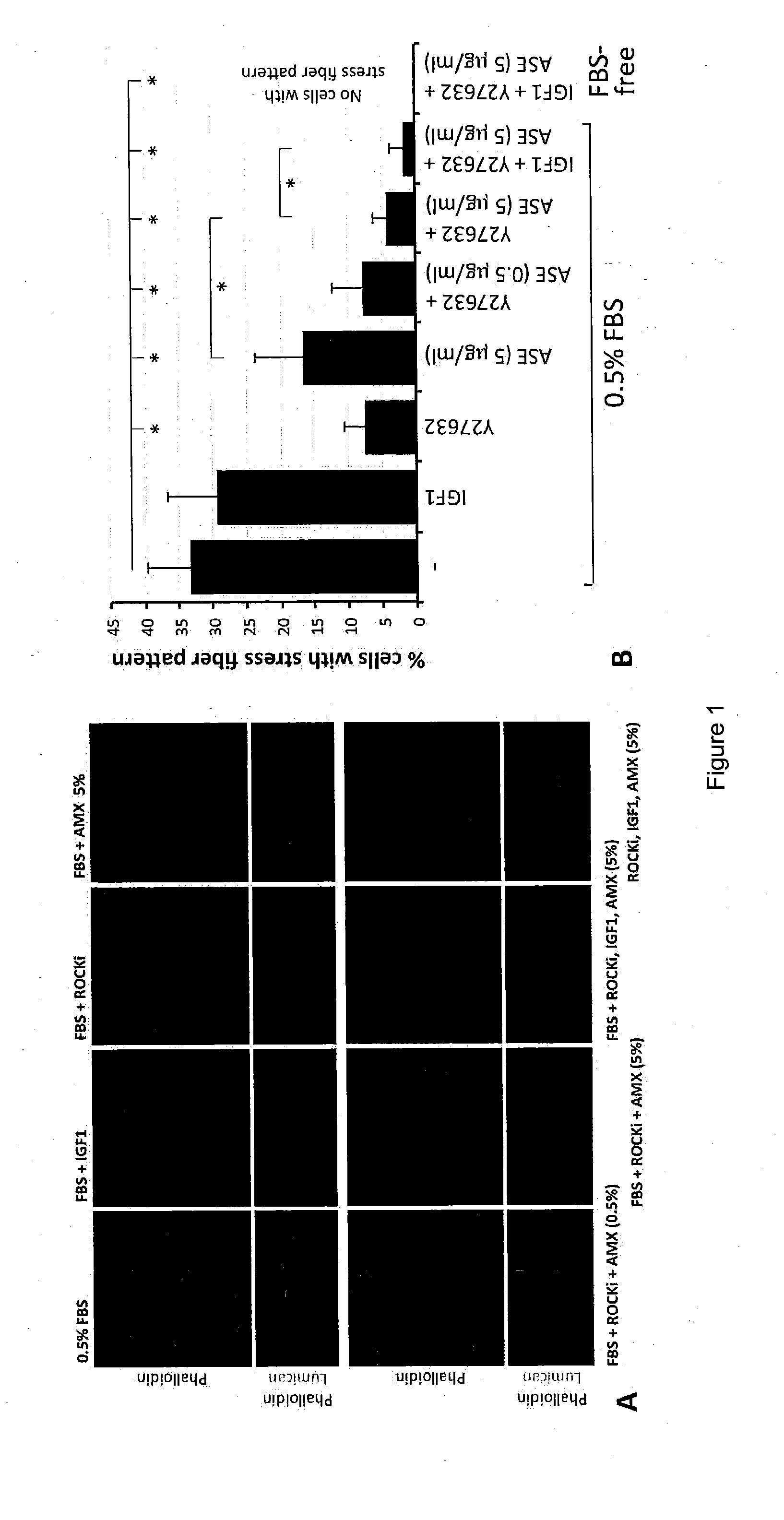 Corneal stromal keratocyte culture