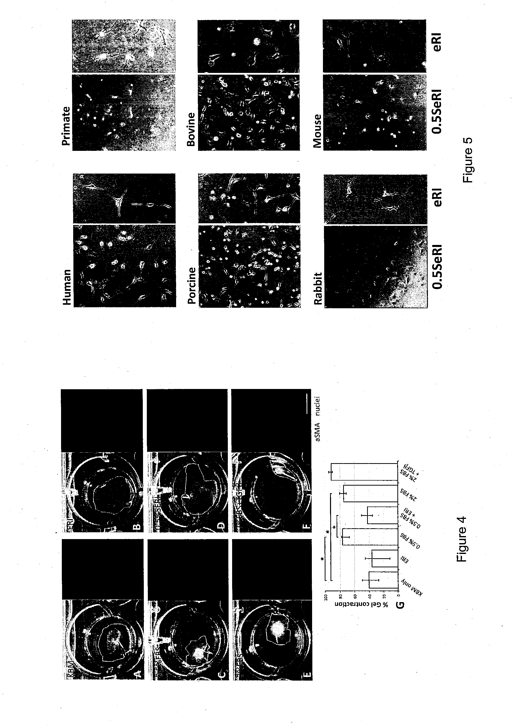 Corneal stromal keratocyte culture